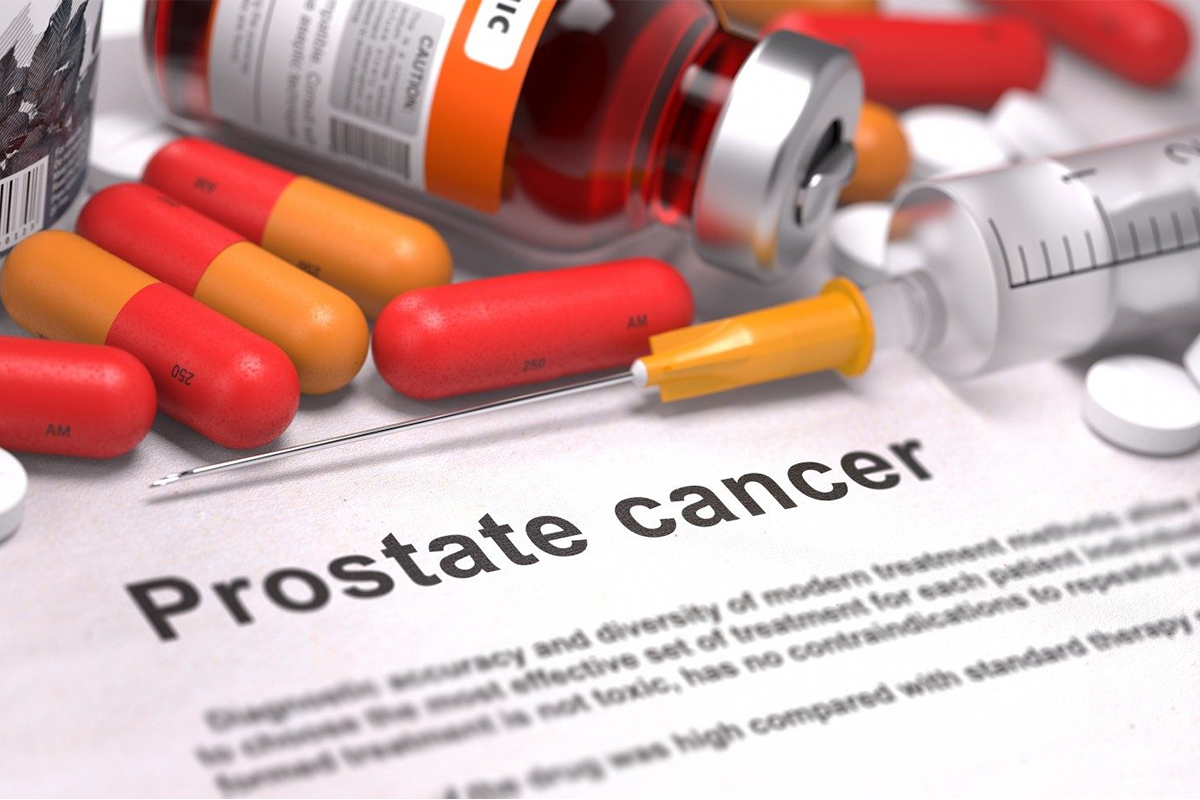 Read more about the article Do all prostate cancers need to be treated?